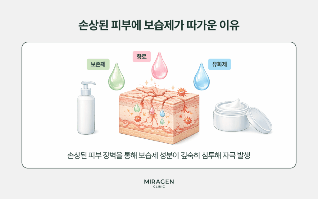 손상된 피부에 보습제가 따가운 이유