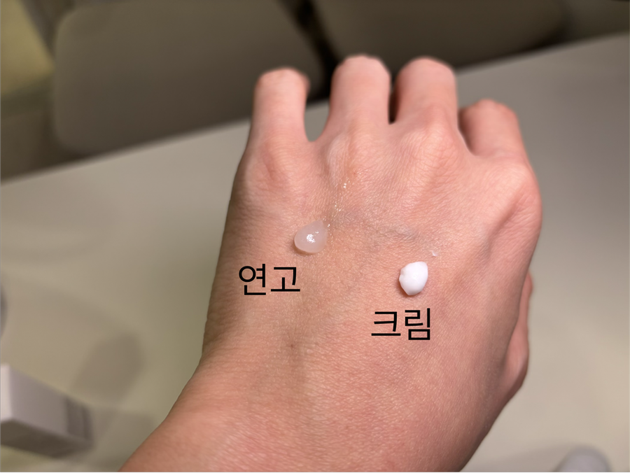 스테로이드 연고와 크림의 제형별 질감 차이를 보여주는 비교 사진으로, 연고는 꾸덕하고 밀폐 효과가 커서 강도가 높고 크림은 발림성이 좋아 일상 사용에 적합함을 설명