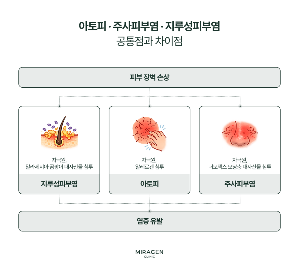 아토피피부염·주사피부염·지루성피부염 세 질환 모두 피부 장벽 손상이 공통 원인이며, 각각 알레르겐·모낭충·말라세지아라는 서로 다른 자극원이 염증을 유발하는 차이를 비교한 인포그래픽