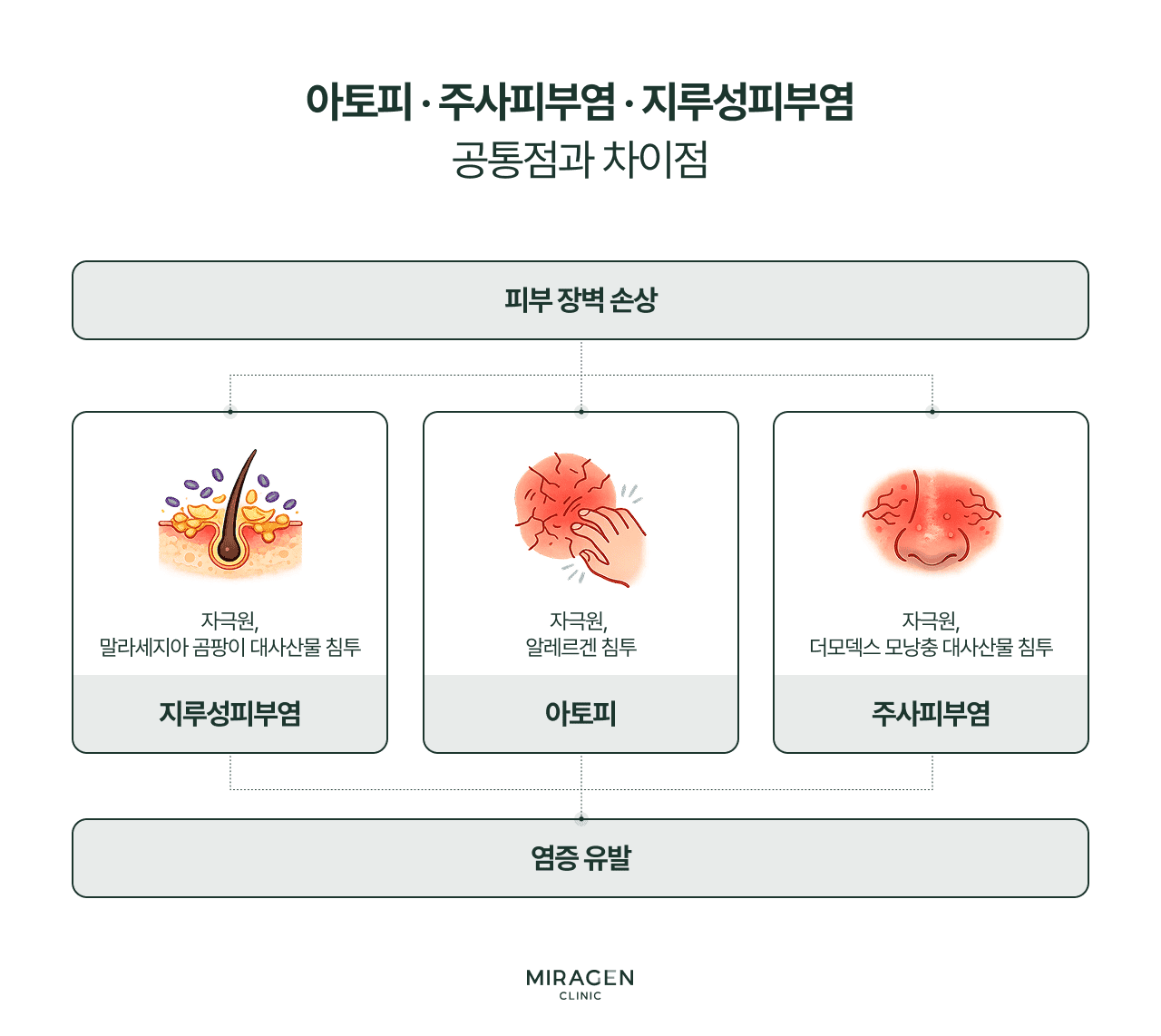 세 질환 비교 인포그래픽 아토피 · 주사피부염 · 지루성피부염을 비교하는 인포그래픽으로, 세 질환 모두 피부 장벽 손상에서 시작하지만 아토피는 알레르겐, 주사피부염은 모낭충, 지루성피부염은 말라세지아가 주요 악화 인자인 차이를 보여줍니다
