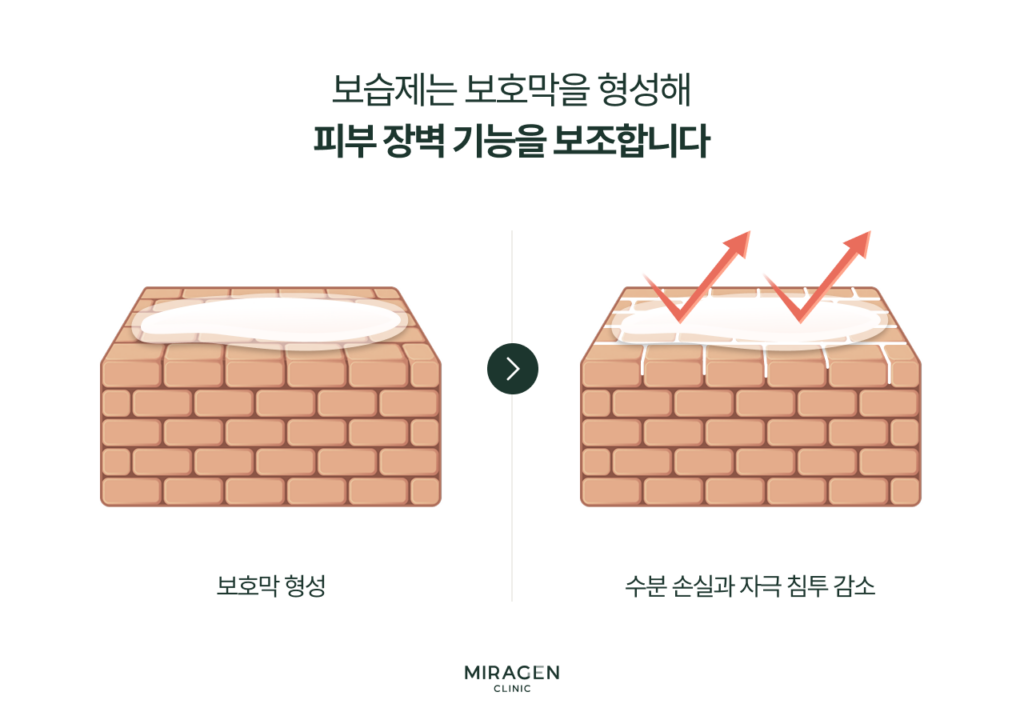 보습제가 피부 표면에 보호막을 형성하여 수분 손실을 줄이고 외부 자극 침투를 차단하는 원리를 피부 단면 일러스트로 설명한 인포그래픽으로, 지루성피부염에서 장벽 보조의 중요성을 강조