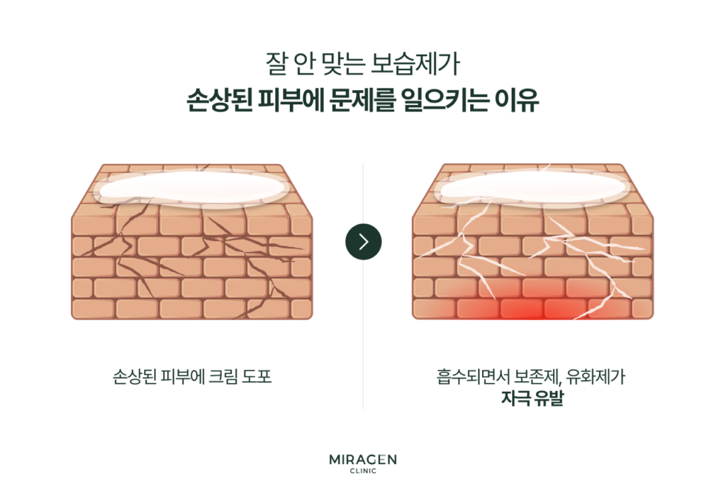 피부 장벽이 손상된 상태에서 맞지 않는 보습제를 바르면 보존제와 유화제가 균열 사이로 침투해 오히려 염증을 악화시키는 과정을 피부 단면으로 보여주는 인포그래픽