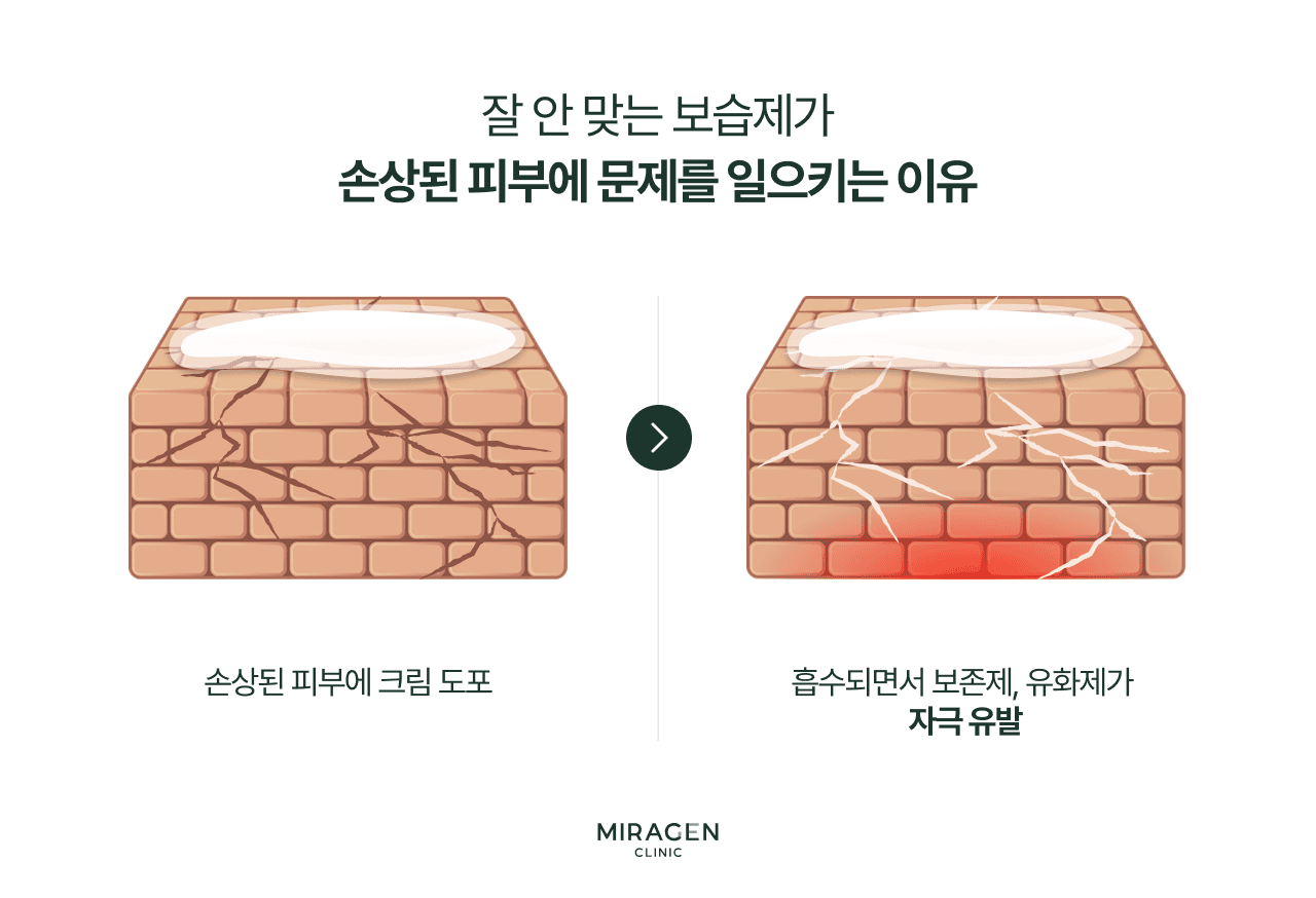 보습제가 손상 피부를 자극하는 원리 손상된 피부 장벽에 맞지 않는 보습제를 바르면 보존제와 유화제가 벽돌담 균열 사이로 과량 침투하여 자극과 염증을 오히려 악화시키는 과정을 설명하는 인포그래픽