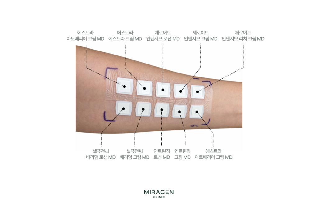 팔 안쪽에 에스트라·제로이드·셀퓨전씨 등 10종의 아토피용 보습 크림을 부착한 첩포 검사 사진으로, 개인별 피부에 맞는 보습제를 선별하는 첩포 검사 과정을 보여줌