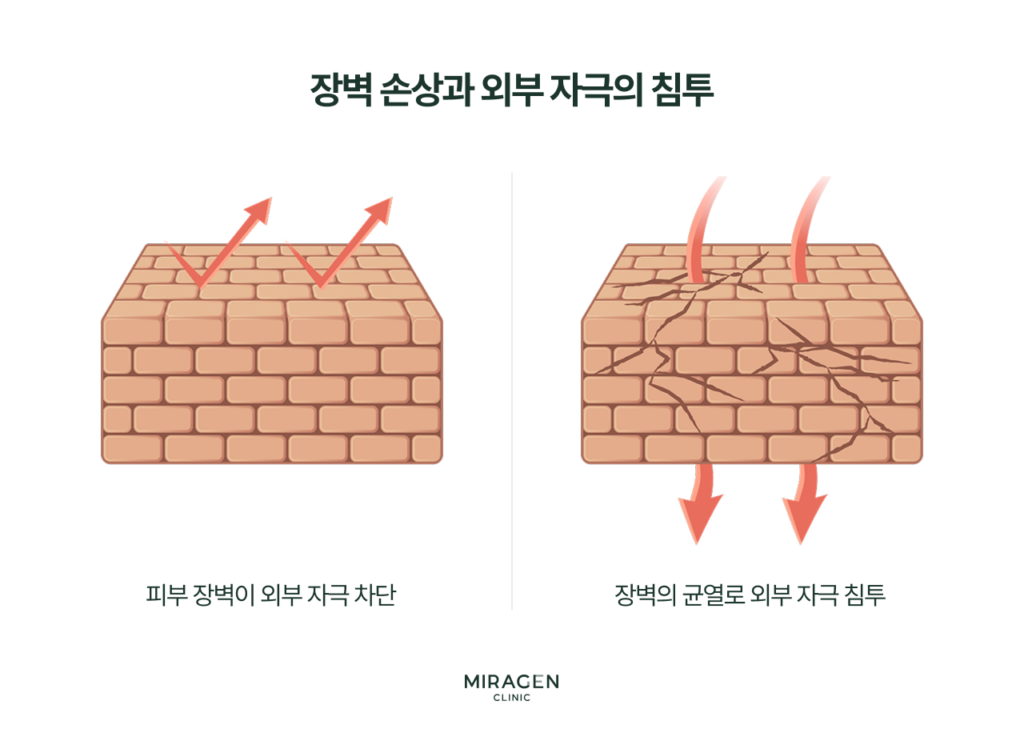주사피부염의 근본 원인을 벽돌담 비유로 설명하는 인포그래픽 — 정상 피부 장벽은 외부 자극을 차단하지만 손상된 피부 장벽은 균열 사이로 자극이 침투하여 아토피 피부염을 유발