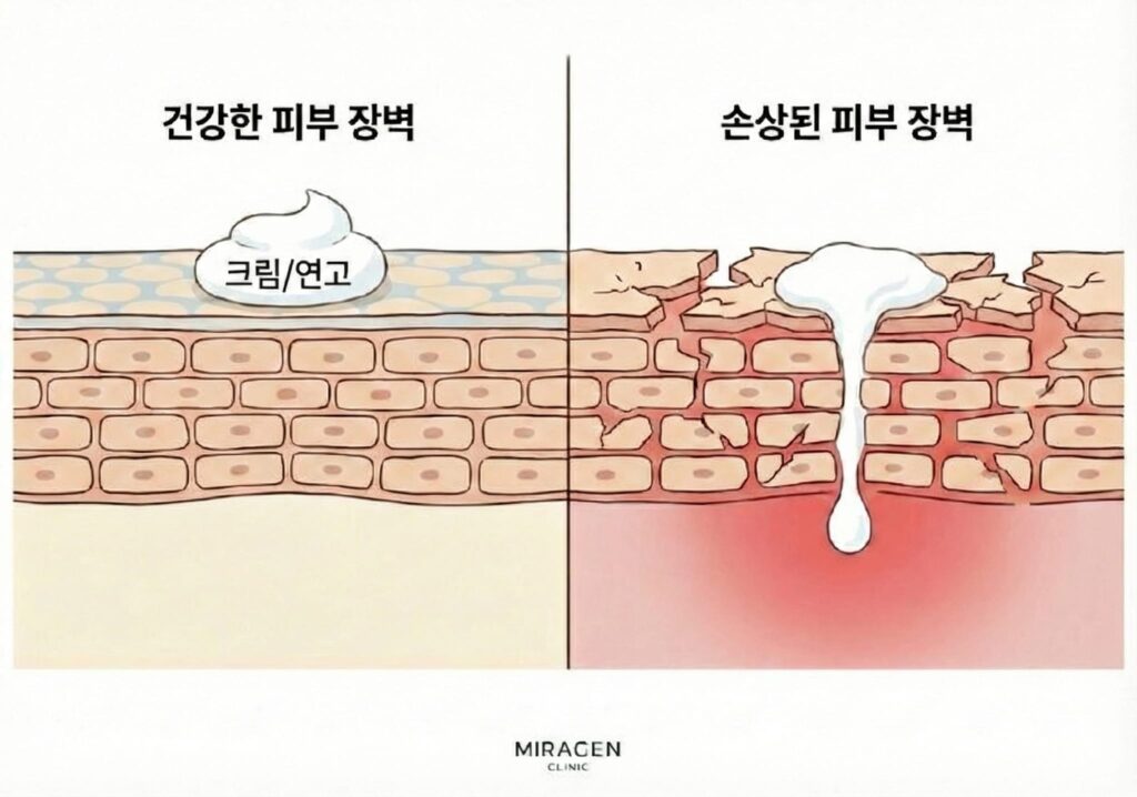 피부 장벽 손상 정도에 따라 스테로이드 연고 흡수율이 달라지는 것을 보여주는 인포그래픽