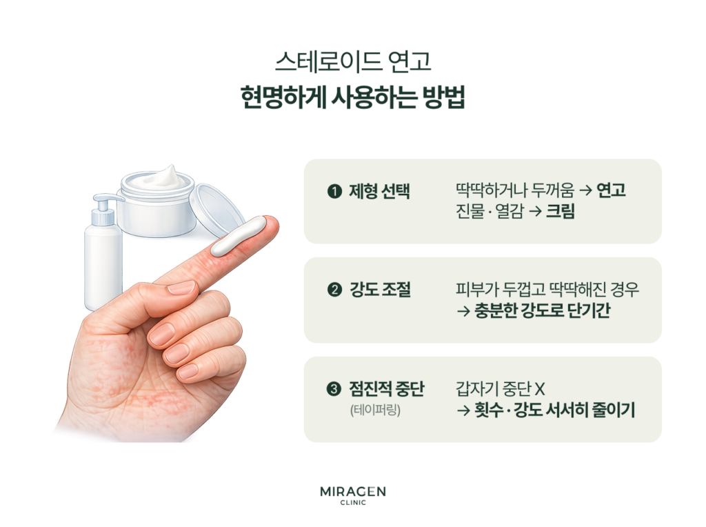 스테로이드 연고를 현명하게 사용하는 세 가지 핵심 방법을 정리한 인포그래픽으로, 등급 확인, 부위별 선택, 사용 기간 준수를 강조