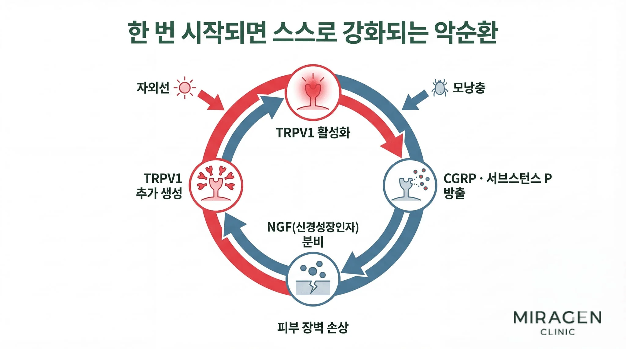 TRPV1 악순환 다이어그램 TRPV1 악순환 과정을 보여주는 순환 다이어그램. TRPV1 활성화에서 CGRP와 서브스턴스 P 방출, NGF 분비, TRPV1 추가 생성으로 이어지는 자기 강화 루프와 자외선, 모낭충, 피부 장벽 손상이 이 순환을 촉발하는 과정을 도식화