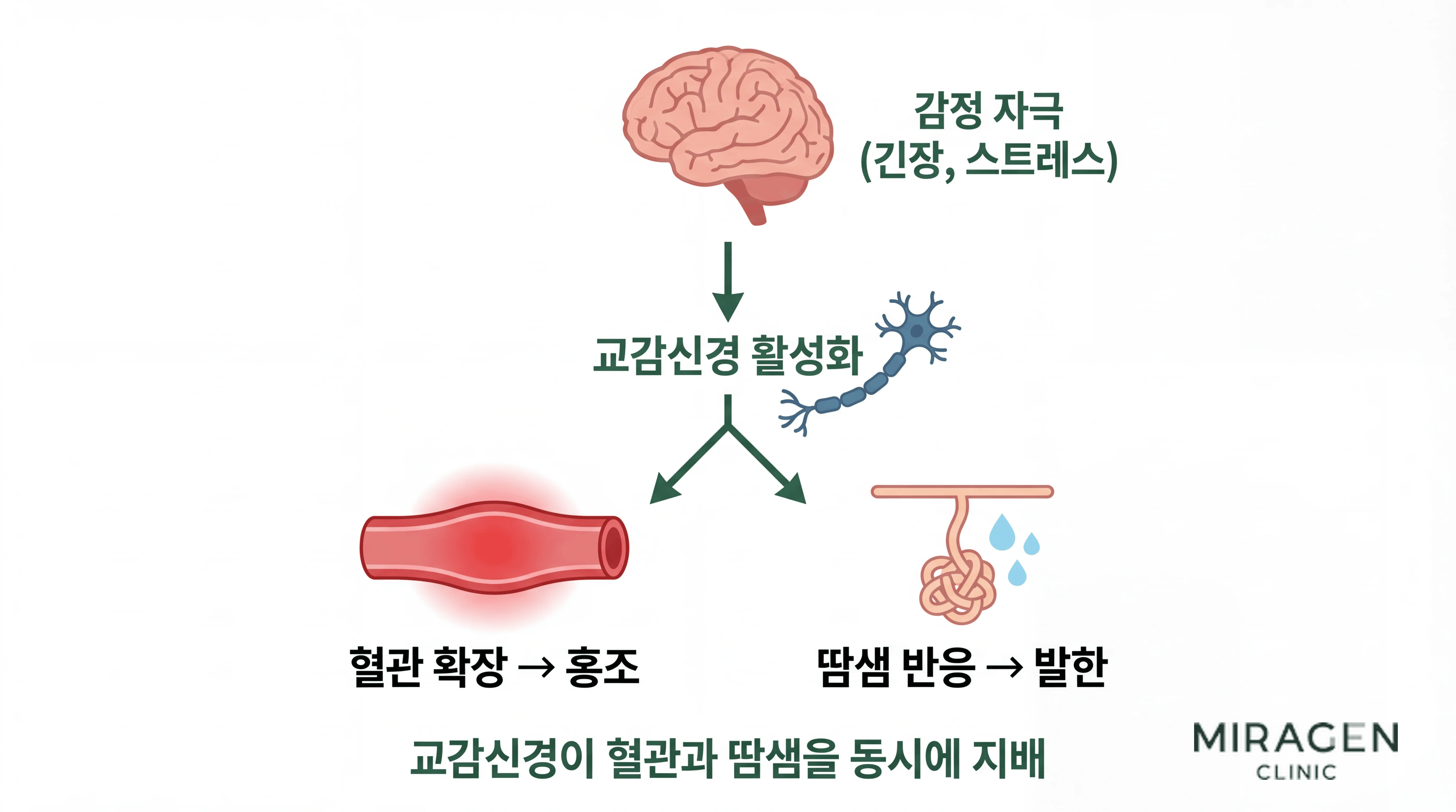감정 홍조의 교감신경 경로를 보여주는 다이어그램. 감정 자극에서 교감신경이 활성화되어 혈관 확장으로 홍조가, 땀샘 반응으로 발한이 동시에 발생하는 과정을 도식화