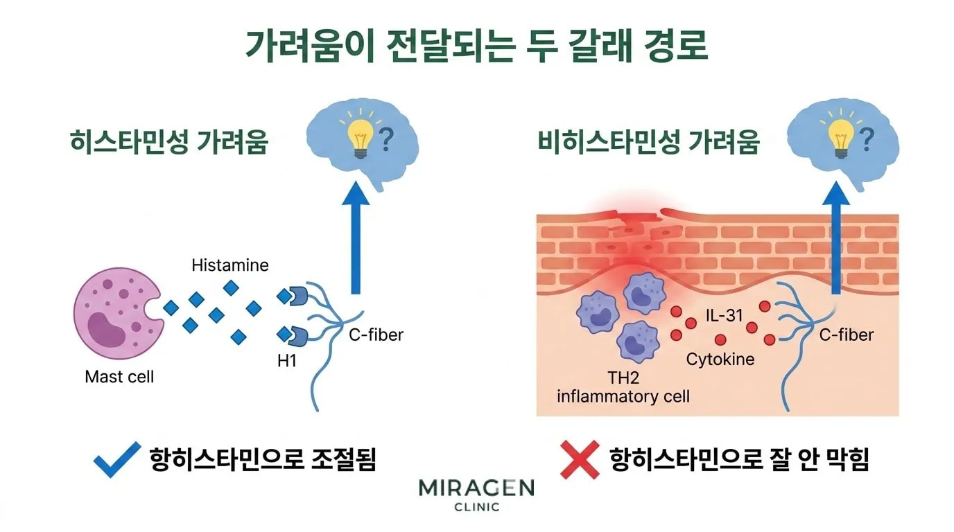 가려움의 히스타민성 · 비히스타민성 경로 비교 가려움 전달 경로를 비교한 일러스트. 왼쪽은 비만세포 히스타민 방출이 C섬유 신경을 자극하는 히스타민성 경로로 항히스타민으로 조절되고, 오른쪽은 IL-31 같은 염증 신호 물질이 감각 신경을 직접 자극하는 비히스타민성 경로로 항히스타민으로 잘 막히지 않는 구조를 설명