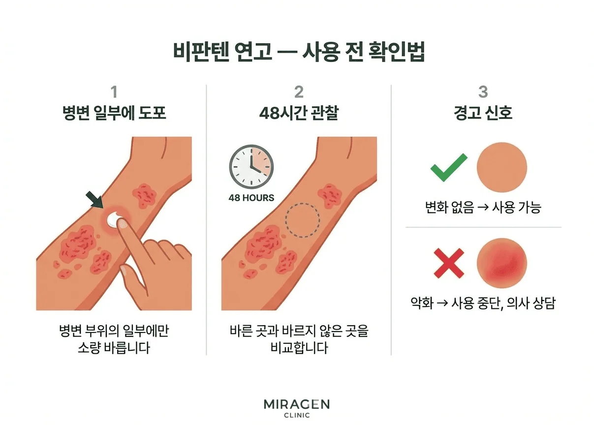 비판텐 연고 사용 전 확인법 3단계 비판텐 연고 사용 전 확인법을 3단계로 설명한 일러스트 — 병변 일부에 도포 후 48시간 관찰하여 악화 여부를 비교하는 자가 테스트 방법