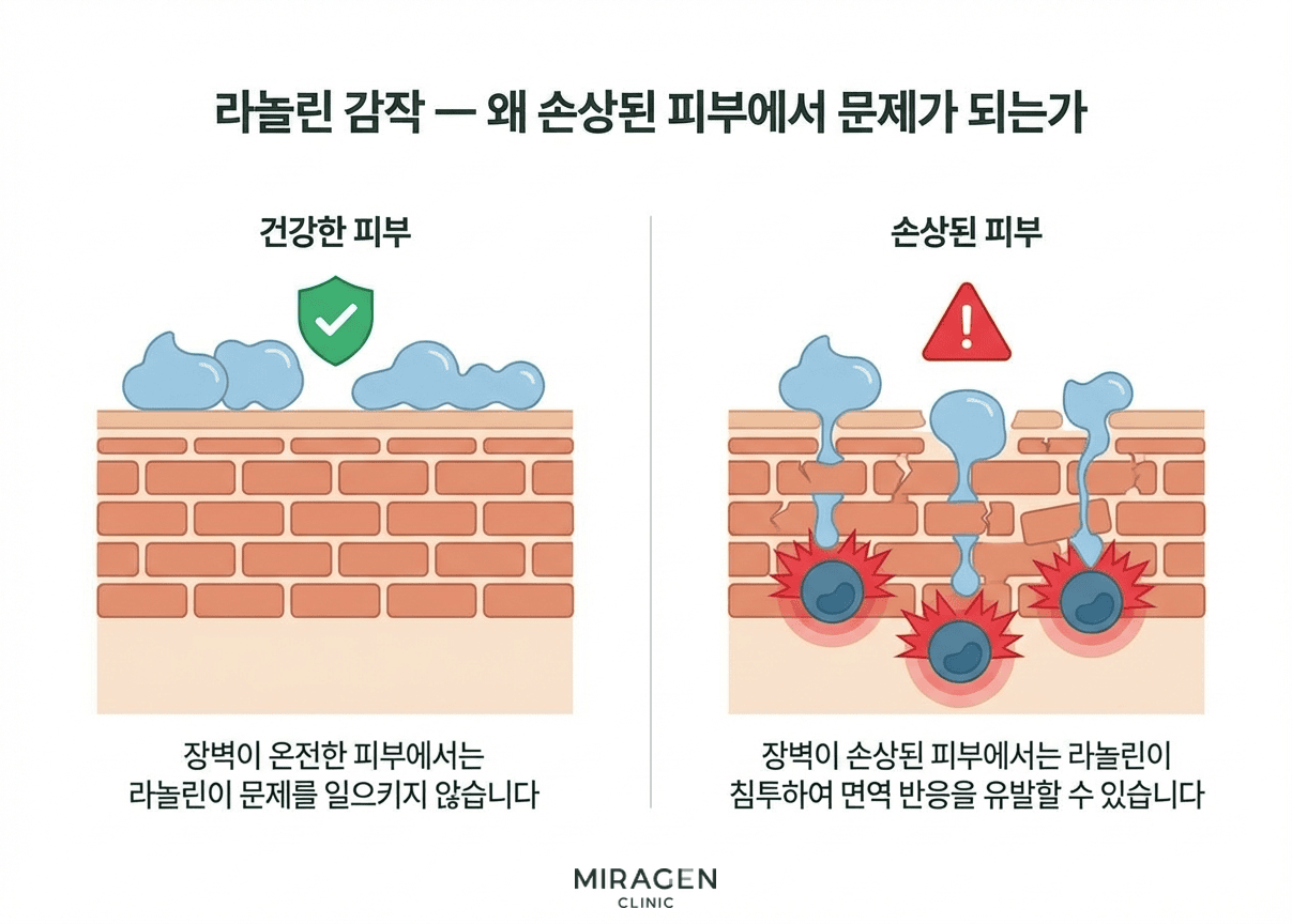 건강한 피부와 손상된 피부에서 라놀린 감작이 일어나는 메커니즘을 비교한 피부 장벽 단면 일러스트 — 장벽이 온전하면 라놀린이 침투하지 못하고 손상되면 면역 반응을 유발