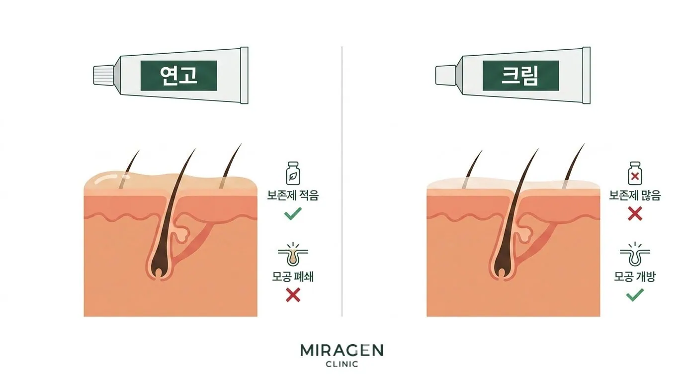 연고와 크림 제형의 피부 단면 비교 일러스트, 연고는 보존제가 적지만 모공을 폐쇄하고 크림은 보존제가 많지만 모공을 덜 막는 차이를 보여주는 얼굴 아토피 연고 선택 가이드