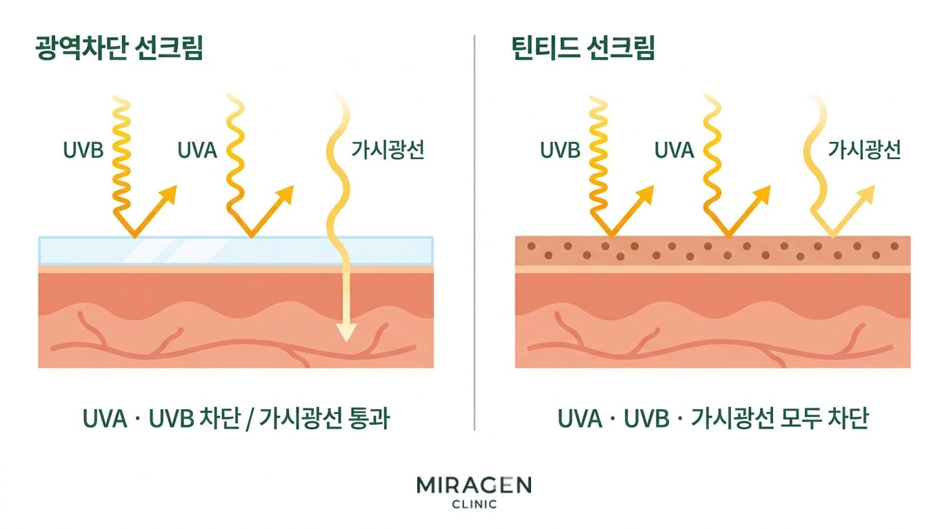 일반 광역차단 선크림과 산화철 기반 틴티드 선크림의 UVA · UVB · 가시광선 차단 범위를 피부 단면으로 비교한 의학 일러스트.