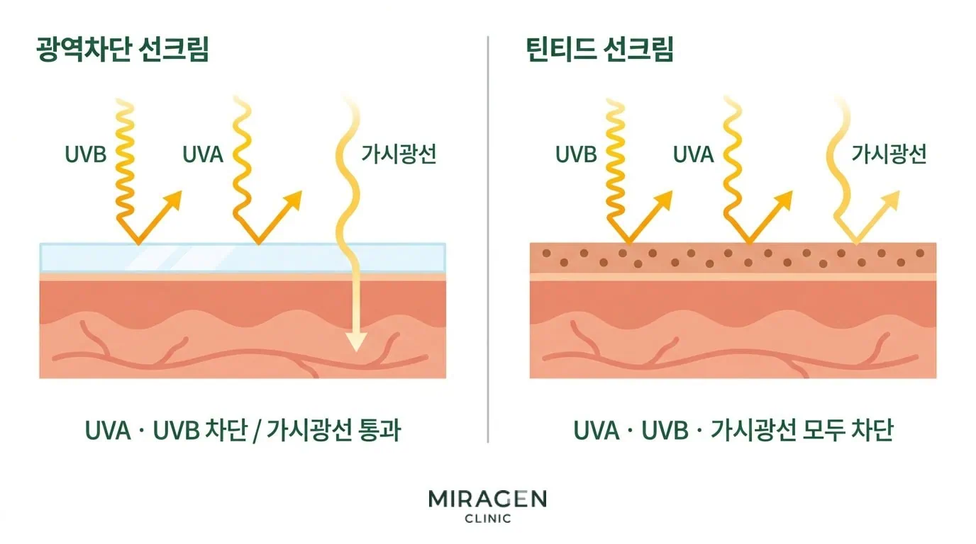 一般的な広域遮断日焼け止めと酸化鉄ベースのティント日焼け止めのUVA・UVB・可視光線遮断範囲を皮膚断面で比較した医学イラスト。