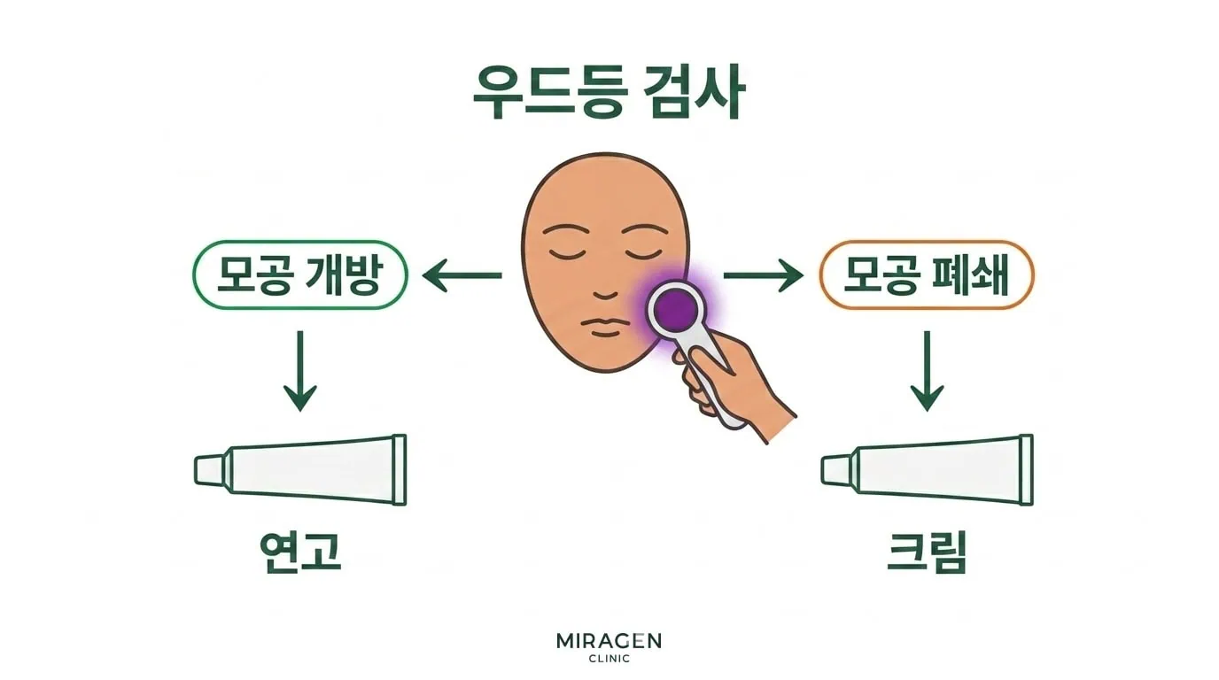 우드등 검사로 모공 상태를 확인한 뒤 모공 개방 시 연고 모공 폐쇄 시 크림을 선택하는 얼굴 아토피 연고 처방 흐름도