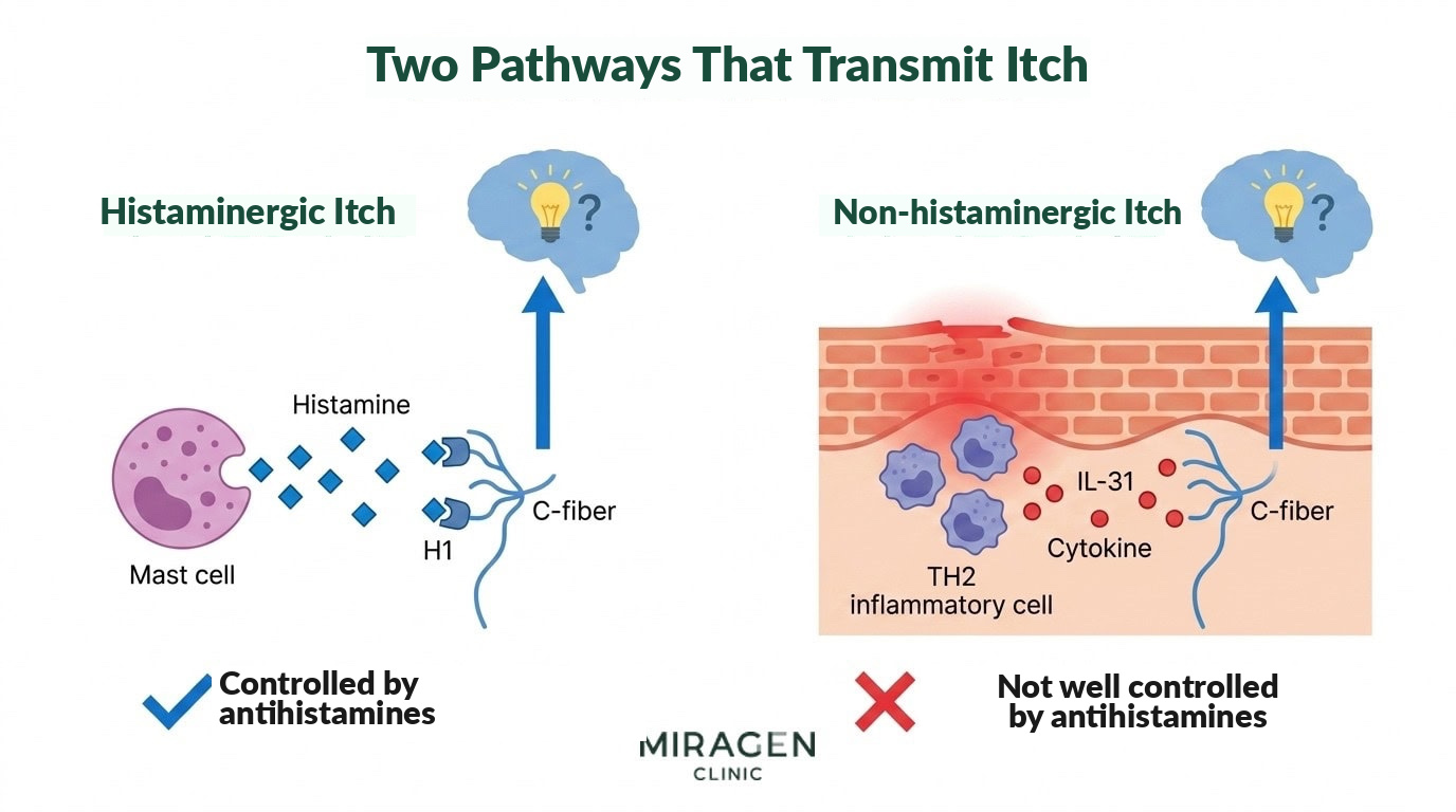 Comparison of Histaminergic and Non-Histaminergic Itch Pathways Illustration comparing itch transmission pathways. On the left, the histaminergic pathway shows mast cell histamine release stimulating C-fiber nerves, controlled by antihistamines. On the right, the non-histaminergic pathway shows inflammatory signaling molecules like IL-31 directly stimulating sensory nerves, a structure not effectively blocked by antihistamines.