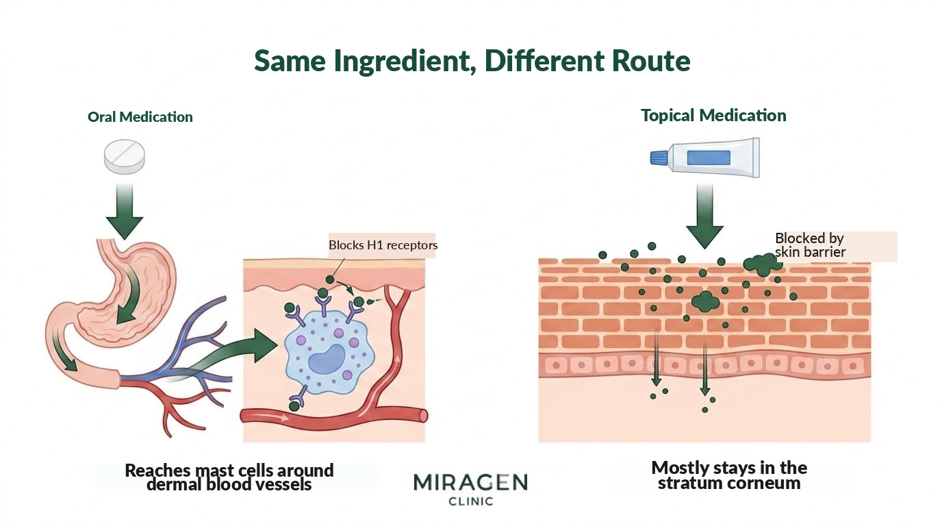 Difference in Pathways Between Oral and Topical Antihistamines Illustration comparing pathways in a left-right split: oral antihistamines pass through the digestive tract to reach and act on H1 receptors on dermal mast cells, while topical antihistamines are blocked by the stratum corneum barrier and remain mostly in the epidermis