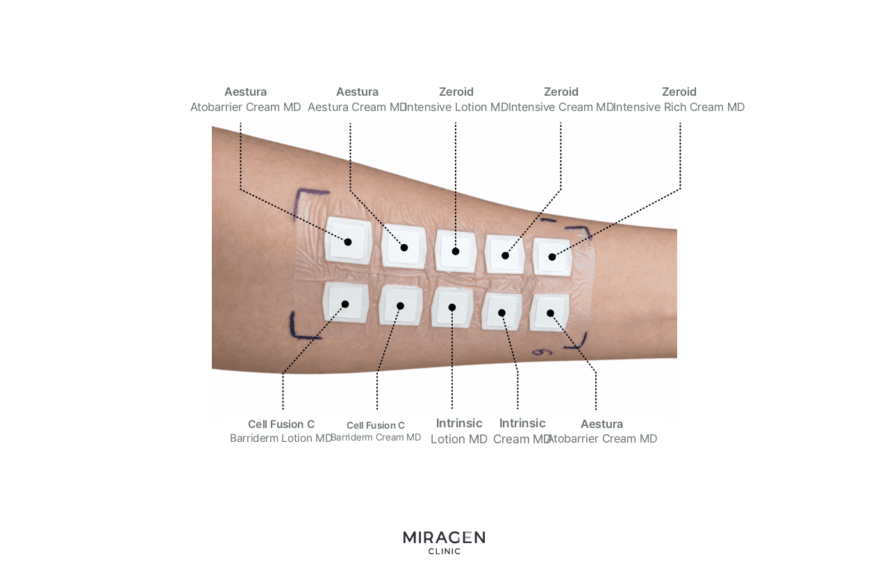 Patch test photo showing 10 atopic moisturizer creams including Atobarrier, Zeroid, and CellFusionC applied to the inner arm, demonstrating the patch testing process for selecting individually suitable moisturizers