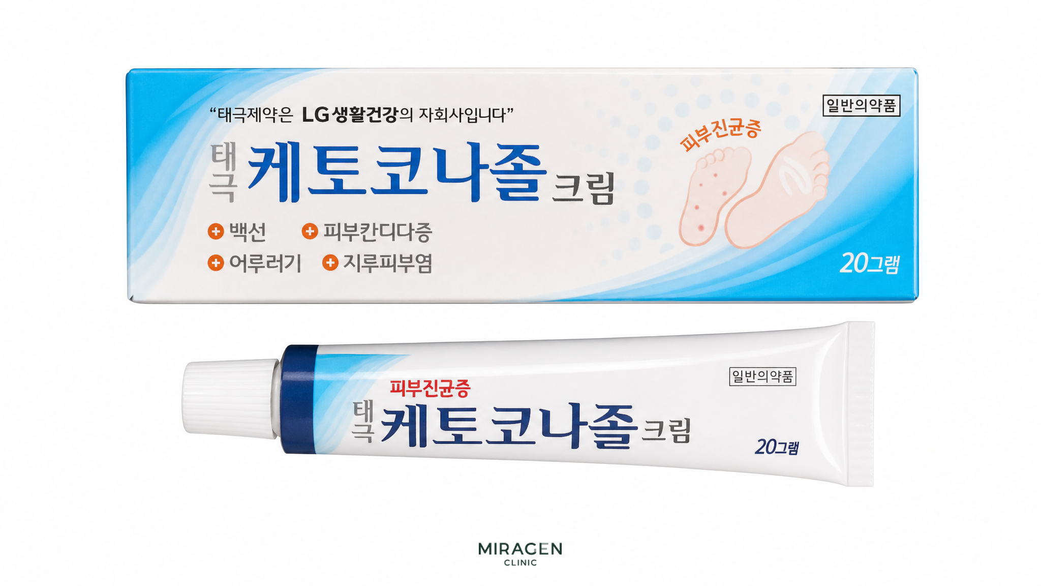 말라세지아 관련 지루성피부염과 어루러기에 쓰는 케토코나졸 20mg/g 크림의 포장과 튜브 제품 사진