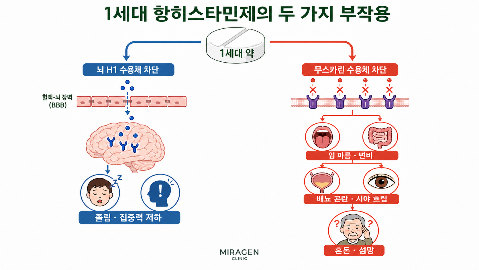 シーザル錠・本文画像 第1世代抗ヒスタミン薬が脳H1受容体遮断により眠気・集中力低下を、ムスカリン受容体遮断により口渇・便秘・排尿困難・視界のぼやけ・錯乱・せん妄を引き起こす2つの経路を比較した図