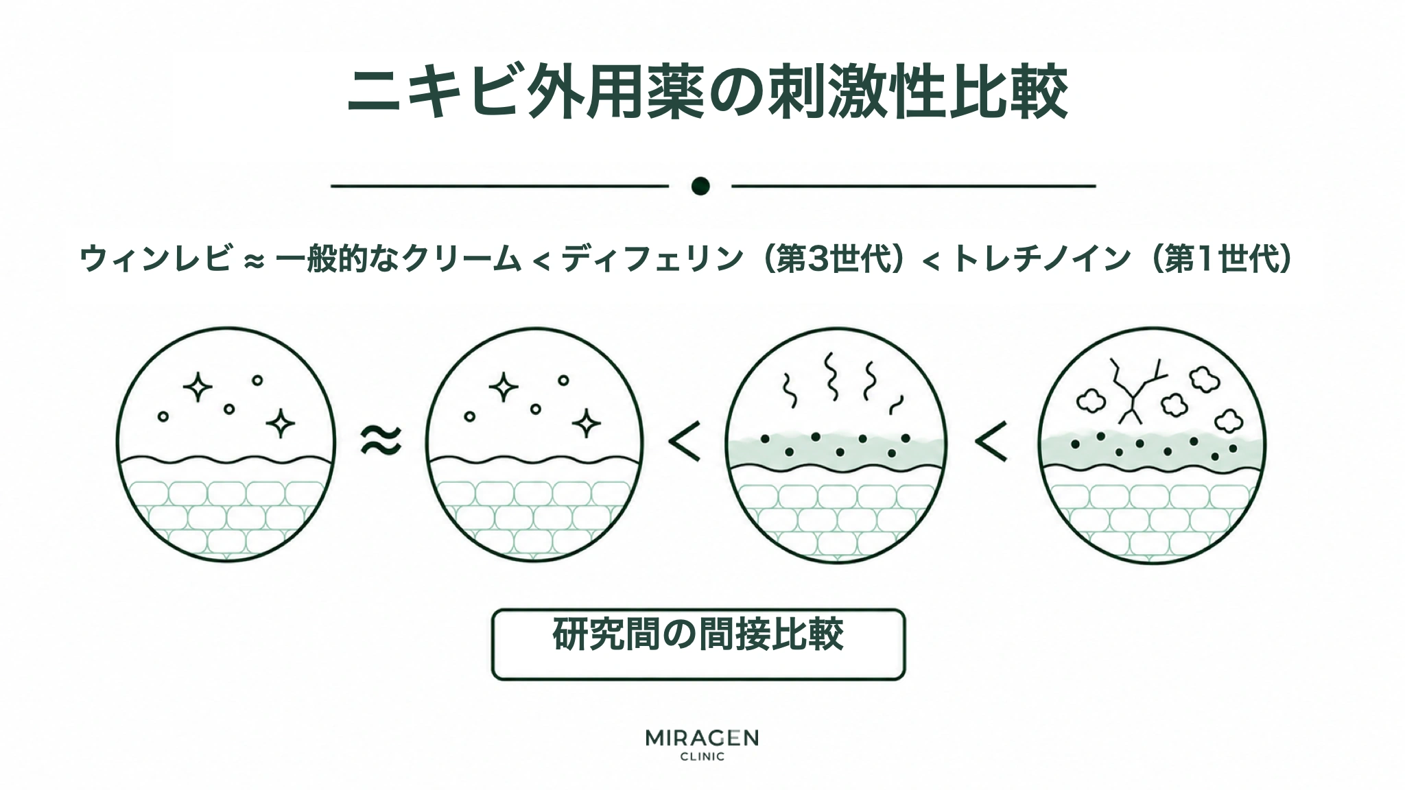 ウィンレヴィクリームと一般クリーム、ディフェリンゲル（第3世代）、トレチノインゲル（第1世代）の皮膚刺激の程度を、1行の順序と4つの皮膚断面図で比較したニキビ外用薬インフォグラフィック