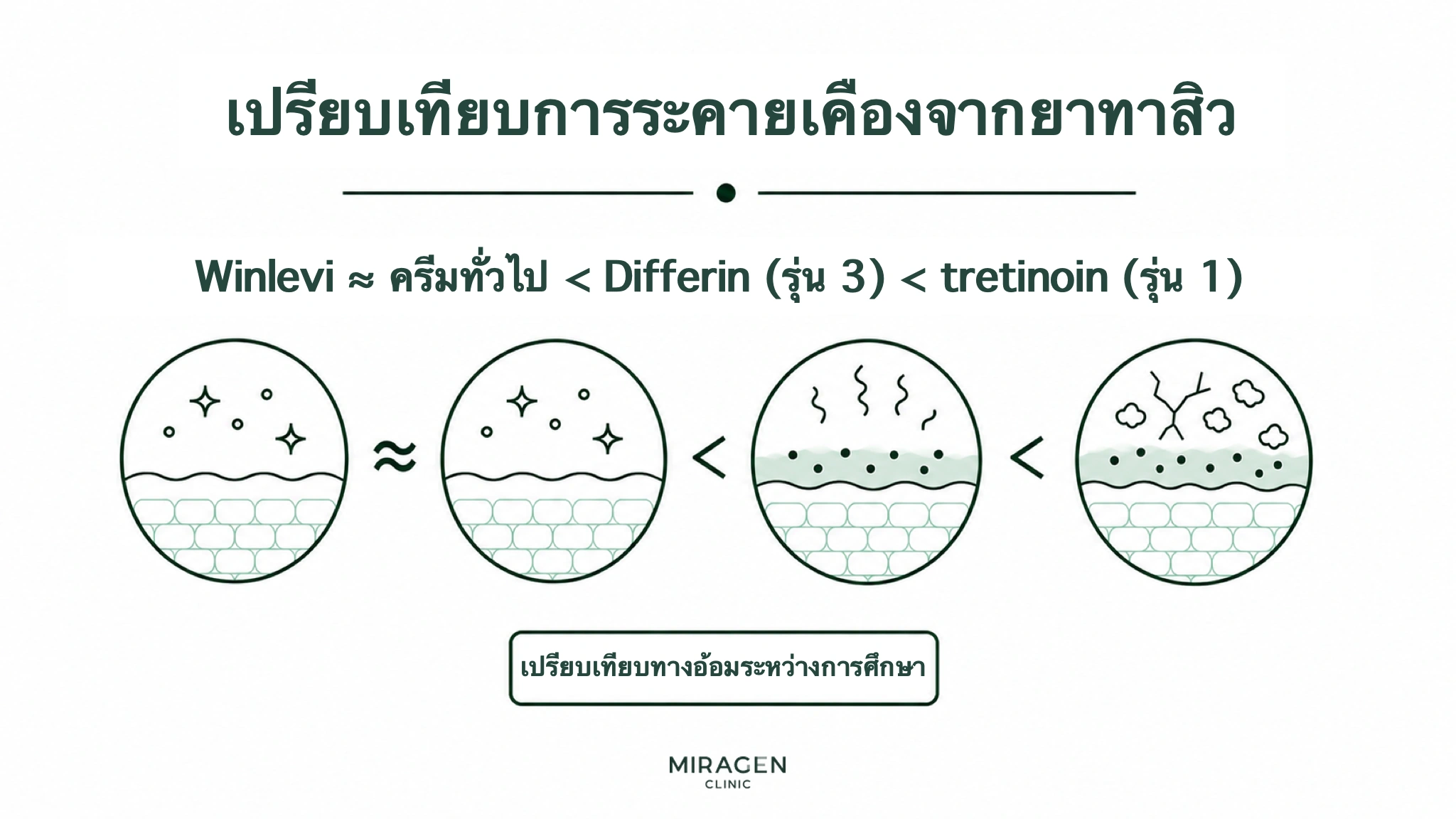 อินโฟกราฟิกเรียงระดับการระคายเคืองของครีมวินเลวี ครีมธรรมดา ดิฟเฟอรินเจลรุ่นที่ 3 และเจลเตรติโนอินรุ่นที่ 1 พร้อมภาพตัดขวางผิวสี่ภาพ