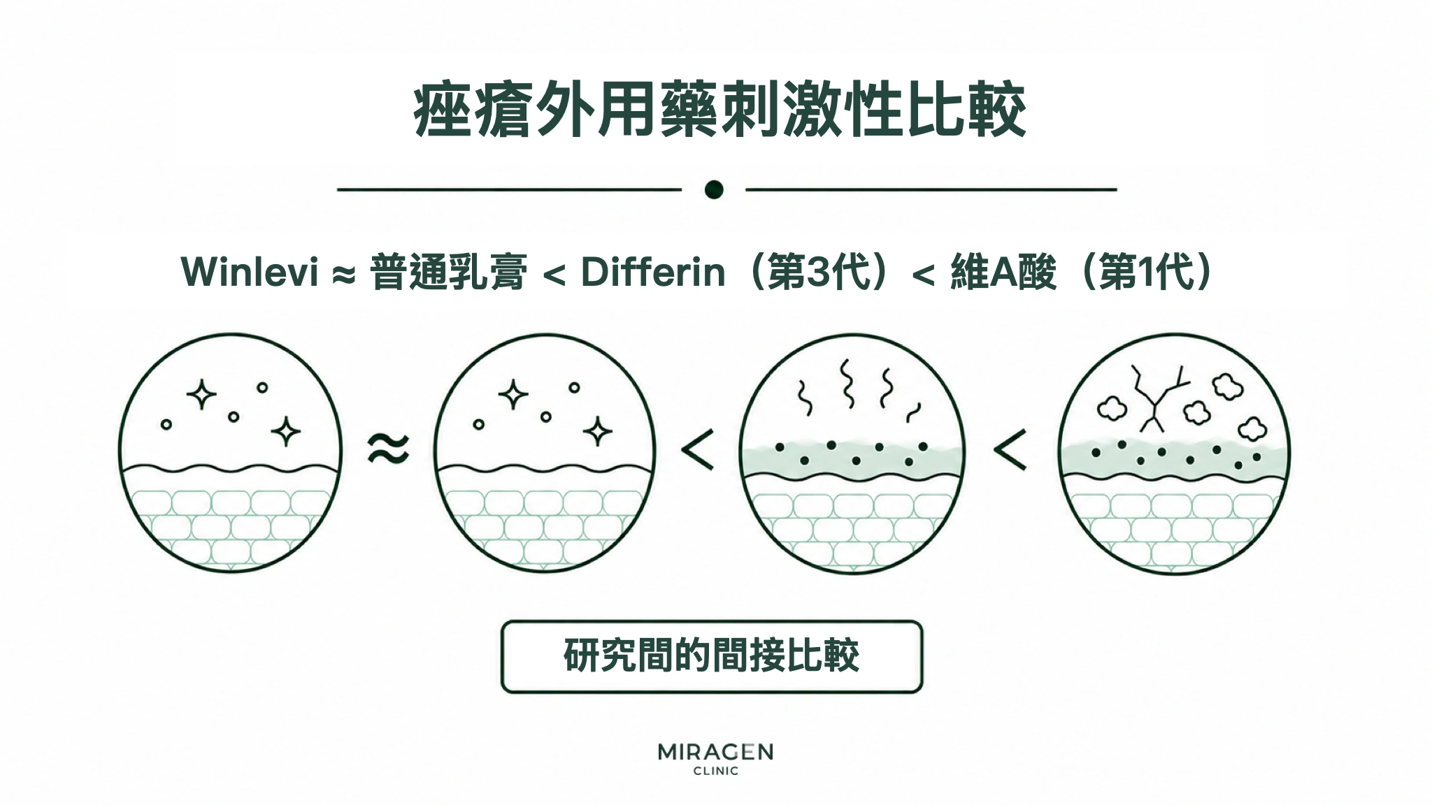 痤瘡外用藥資訊圖，用一條順序線和四幅皮膚剖面圖，比較 Winlevi 乳膏、普通乳膏、第三代Differin凝膠及第一代維A酸凝膠的皮膚刺激程度