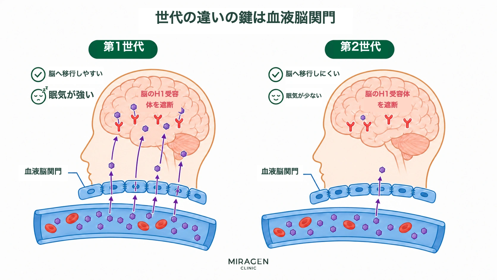 フェニラミン錠のような第1世代抗ヒスタミン薬は血液脳関門を多く通過して脳のH1受容体をブロックし眠気が顕著ですが、第2世代は脳への流入が少なく眠気が抑えられるという違いを示した図