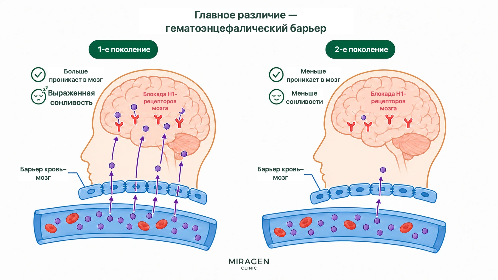 Схема сравнивает антигистаминные средства первого поколения, которые чаще проходят в мозг и вызывают сонливость, с цетиризином второго поколения, который проникает меньше