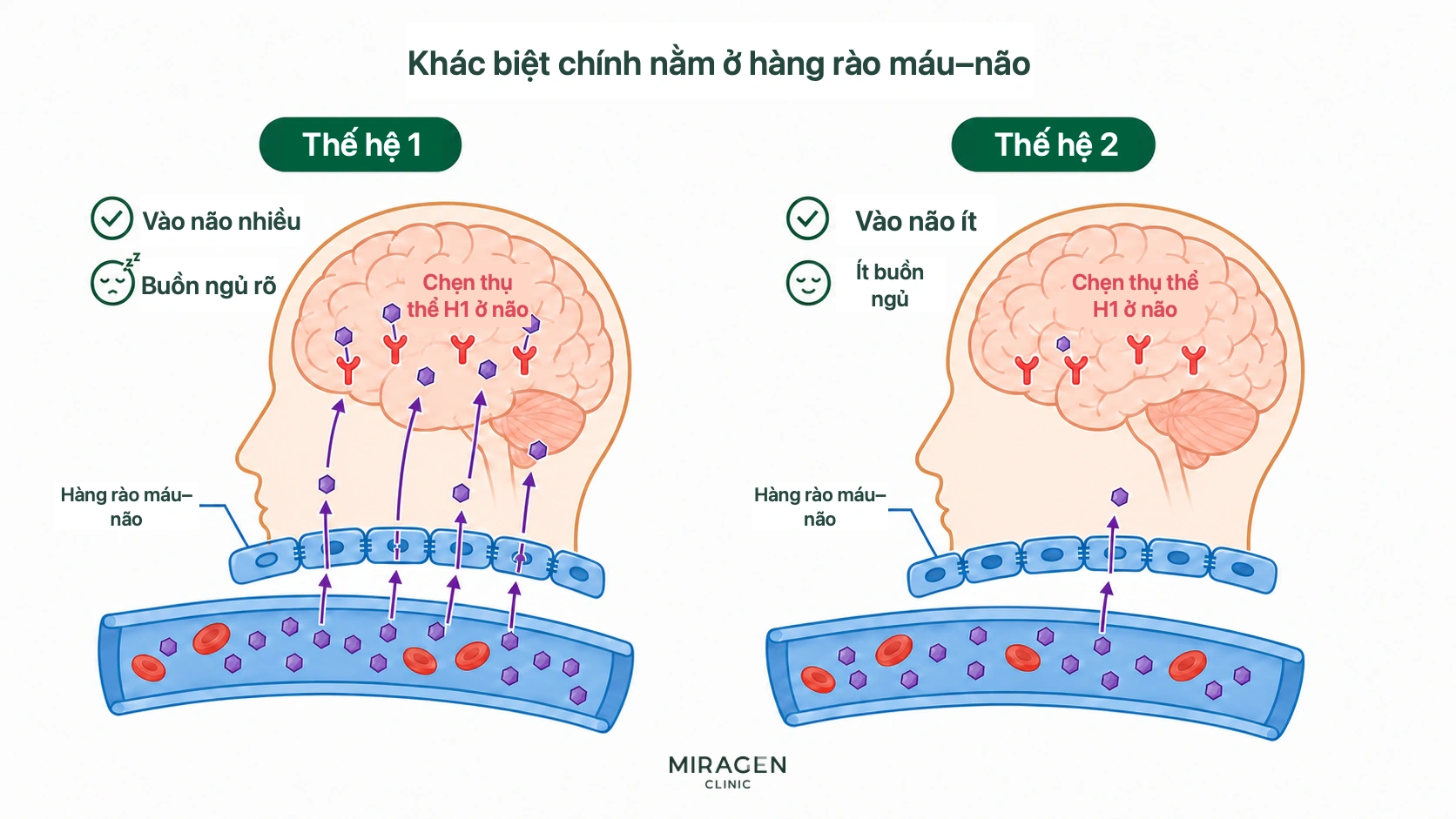 Hình so sánh thuốc kháng histamine thế hệ 1 như Peniramin đi qua hàng rào máu não nhiều và chặn H1 trong não nên gây buồn ngủ rõ, với thuốc thế hệ 2 ít vào não và ít gây buồn ngủ hơn