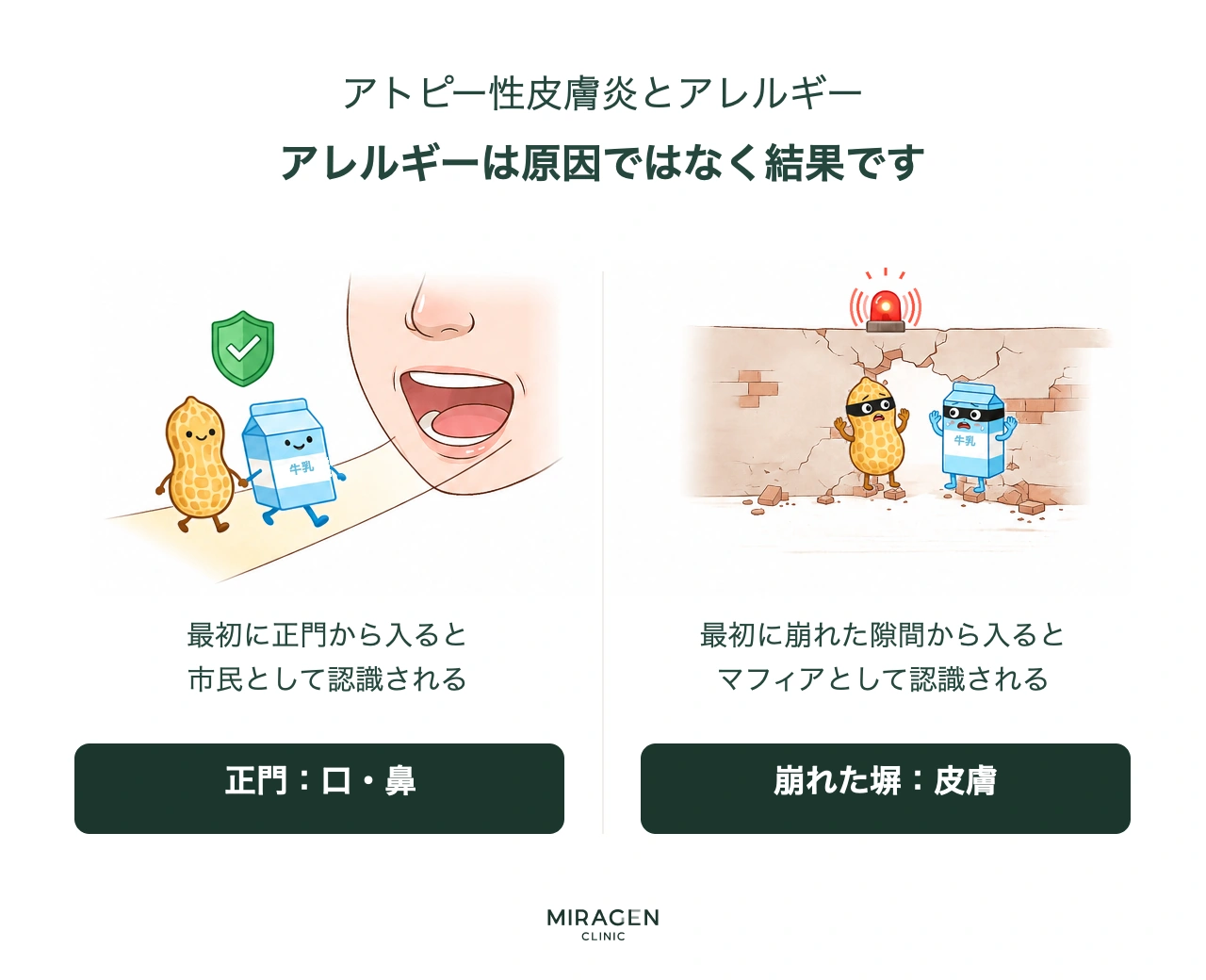 アトピーとアレルギーの関係を市民・マフィアの比喩で説明するインフォグラフィックで、口から入った食べ物は市民として認識され、崩れた皮膚バリアの隙間から入ると免疫がマフィアとして認識する原理を視覚化
