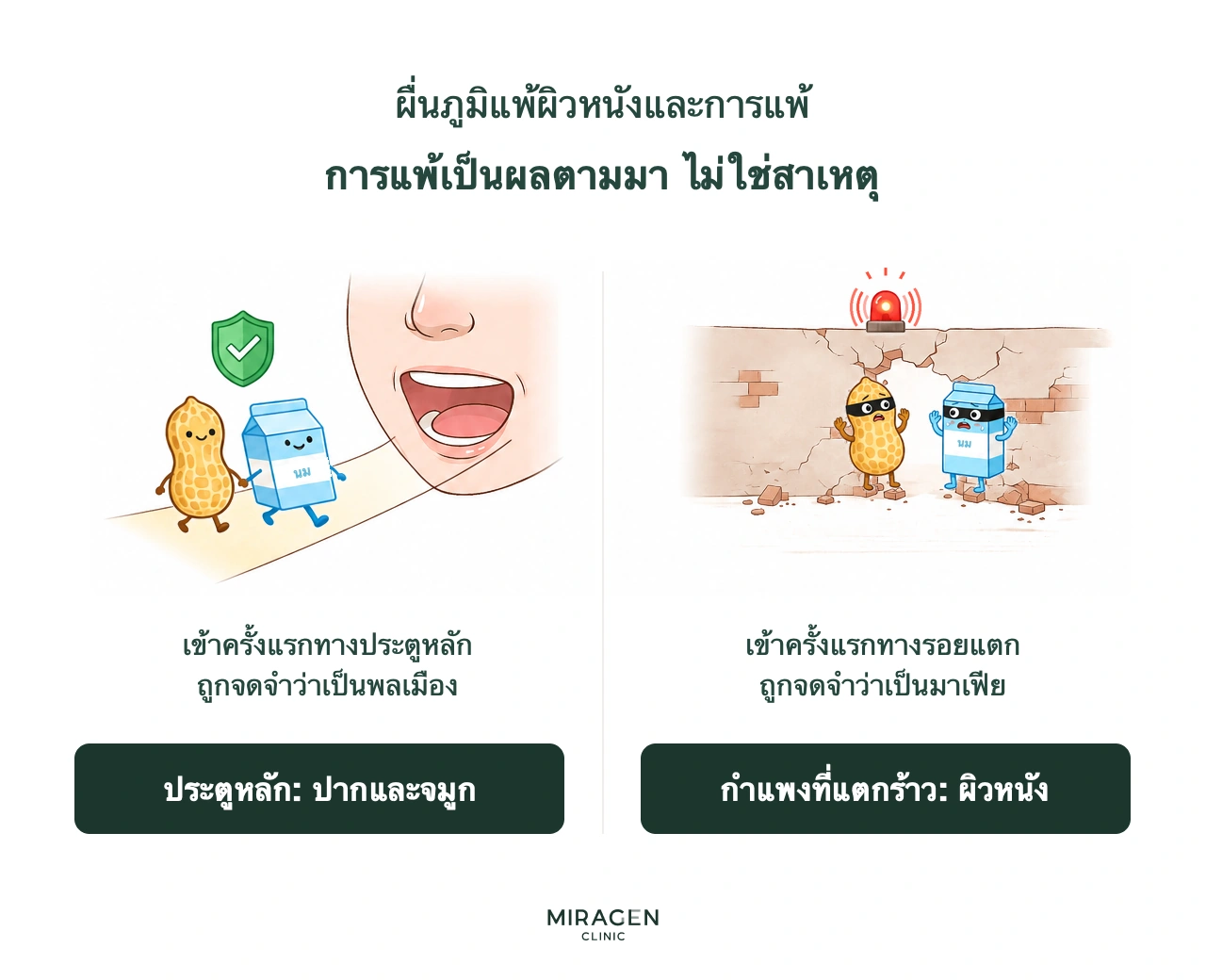 อินโฟกราฟิกเปรียบเทียบพลเมืองกับมาเฟียเพื่ออธิบายภูมิแพ้ อาหารที่เข้าทางปากถูกมองว่าปลอดภัย แต่เมื่อเข้าทางช่องว่างของเกราะผิวที่เสียหาย ภูมิคุ้มกันอาจมองว่าเป็นภัย
