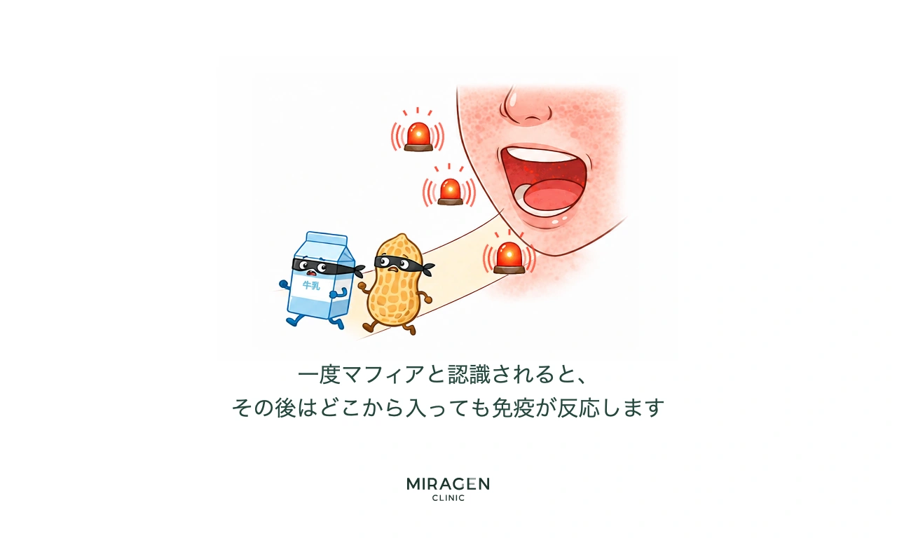 一度マフィアとして認識された牛乳・ピーナッツが泥棒マスクをつけて口から侵入し免疫警報が鳴るシーンで、皮膚バリア損傷後に食物アレルギーが全身に拡散する過程を説明するイラスト