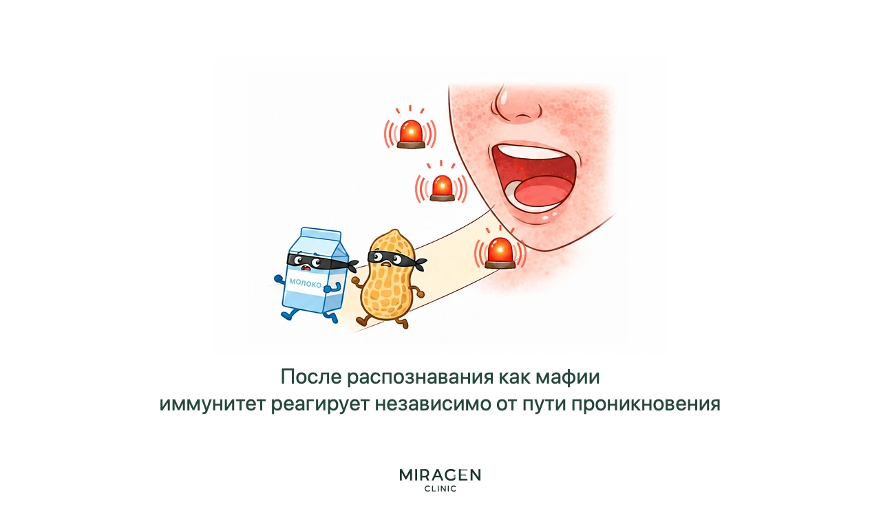 Молоко и арахис, уже ошибочно принятые иммунитетом за угрозу, входят через рот в масках воров и вызывают сигнал тревоги; иллюстрация объясняет развитие пищевой аллергии после повреждения кожного барьера