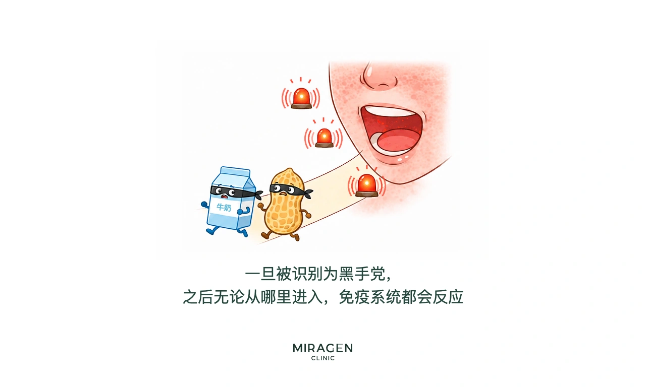 插图中曾被当作危险物质的牛奶和花生戴着小偷面具，经口进入时引发免疫警报，说明皮肤屏障受损后食物过敏反应可能扩展到全身