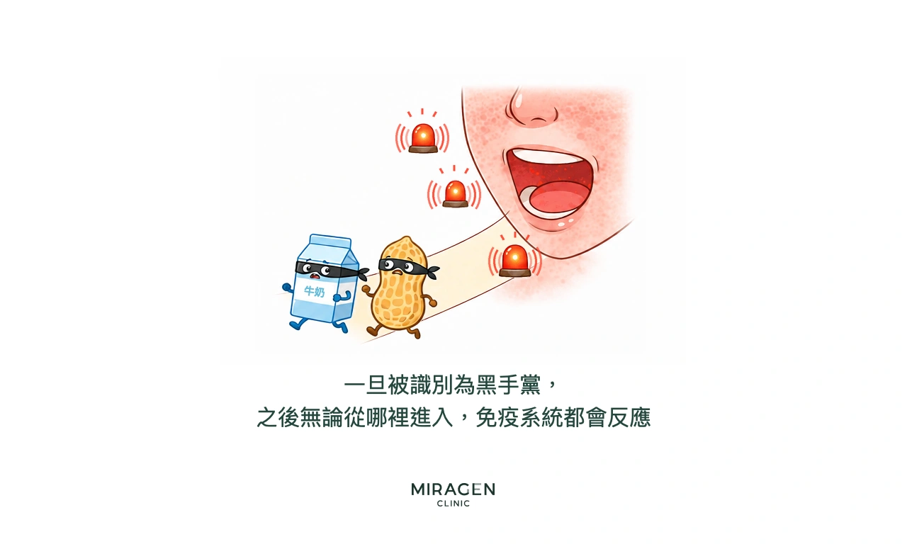 插圖中曾被當作危險物質的牛奶和花生戴著小偷面具，經口進入時引發免疫警報，說明皮膚屏障受損後食物過敏反應可能擴展到全身