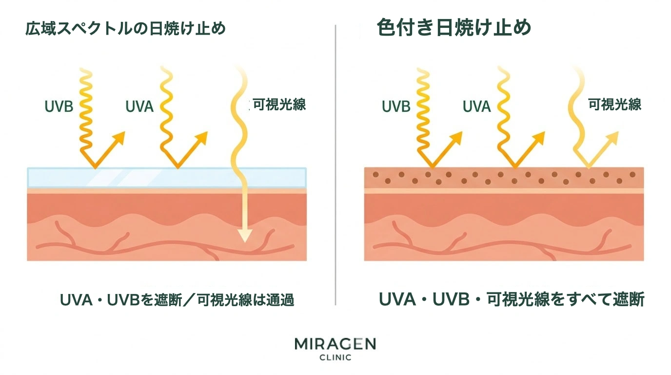 一般的な広域遮断日焼け止めと酸化鉄ベースのティント日焼け止めのUVA・UVB・可視光線遮断範囲を皮膚断面で比較した医学イラスト。