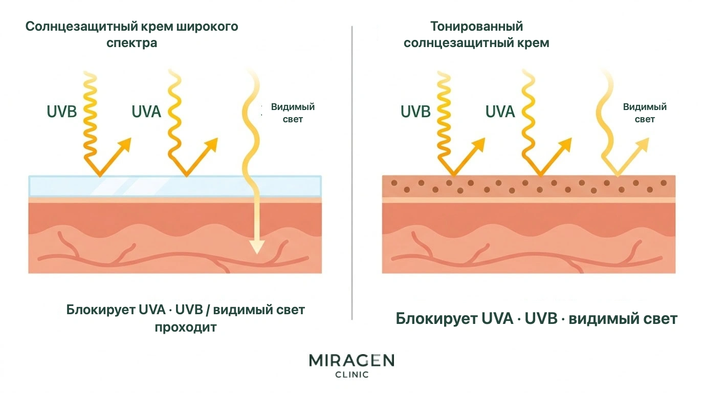 Медицинская иллюстрация поперечного среза кожи сравнивает защиту от UVA, UVB и видимого света обычным кремом широкого спектра и тонированным средством с оксидами железа