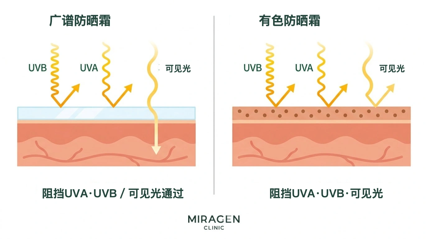 医学插图：在皮肤剖面中比较普通广谱防晒霜与含氧化铁的有色防晒霜对 UVA、UVB 和可见光的防护范围