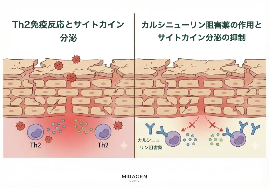 エリデルのようなカルシニューリン阻害薬がT細胞のTh2免疫反応を遮断し、炎症を抑える原理を示したイラスト