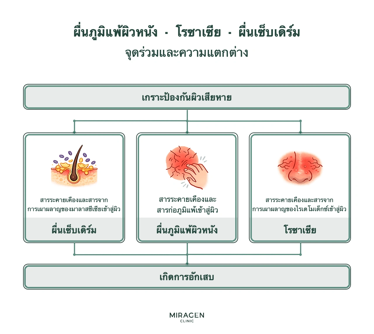 อินโฟกราฟิกเปรียบเทียบผื่นภูมิแพ้ผิวหนัง โรซาเซีย และผิวหนังอักเสบเซ็บเดิร์ม ทั้งสามเริ่มจากเกราะป้องกันผิวเสียหาย แต่มีสารก่อภูมิแพ้ ไรเดโมเด็กซ์ และมาลาสซีเซียเป็นปัจจัยกระตุ้นต่างกัน