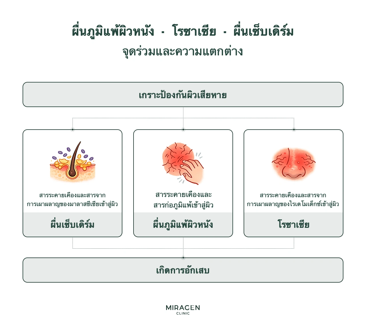 อินโฟกราฟิกเปรียบเทียบผื่นภูมิแพ้ผิวหนัง โรซาเซีย และผิวหนังอักเสบเซ็บเดิร์ม ซึ่งล้วนมีเกราะผิวเสียหาย แต่ต่างกันที่สารก่อภูมิแพ้ ไรเดโมเด็กซ์ และมาลาสซีเซีย