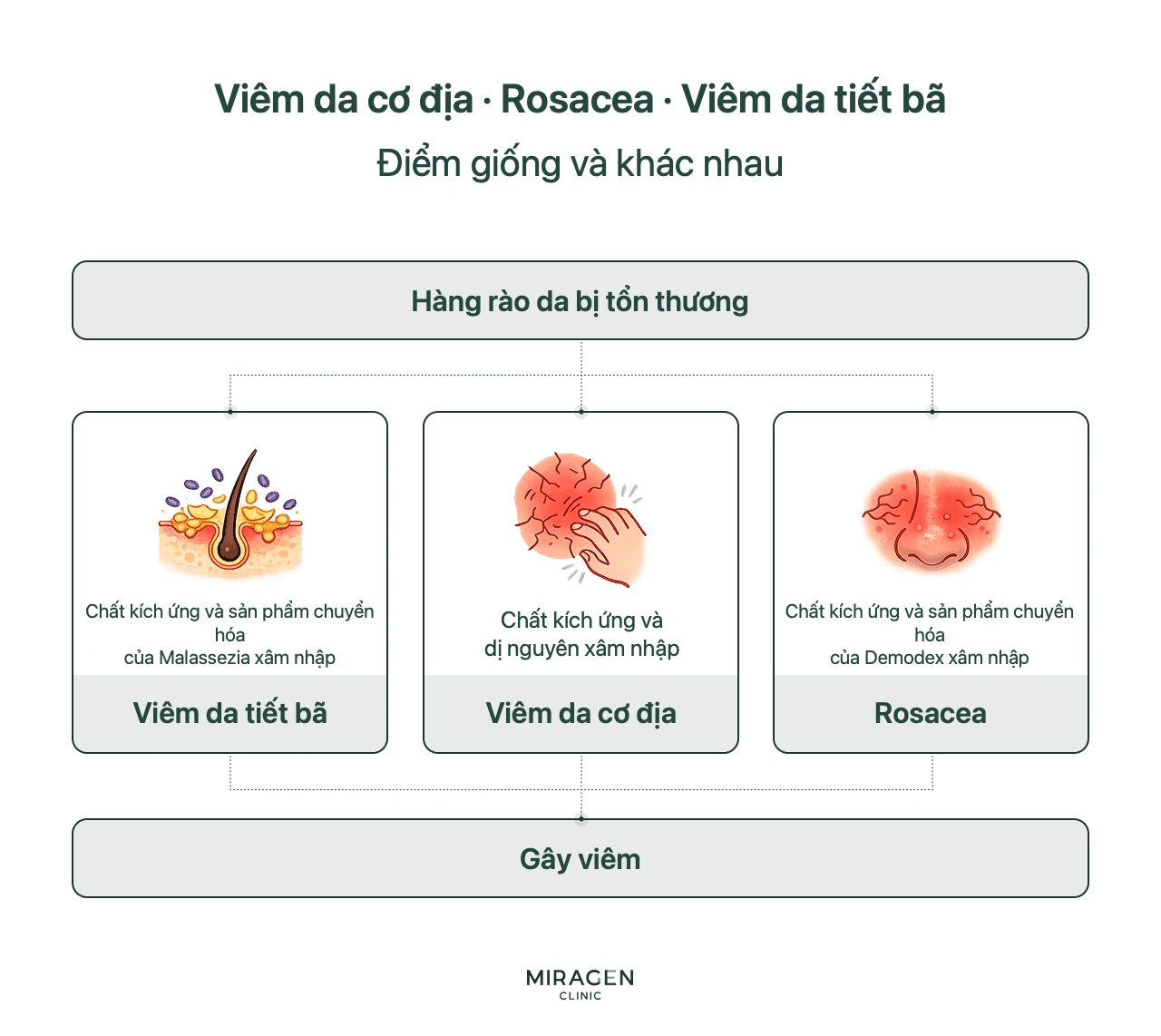 Sơ đồ so sánh ba bệnh cùng bắt đầu từ hàng rào da tổn thương: rosacea chịu tác động từ Demodex, viêm da cơ địa từ dị nguyên, viêm da tiết bã từ Malassezia