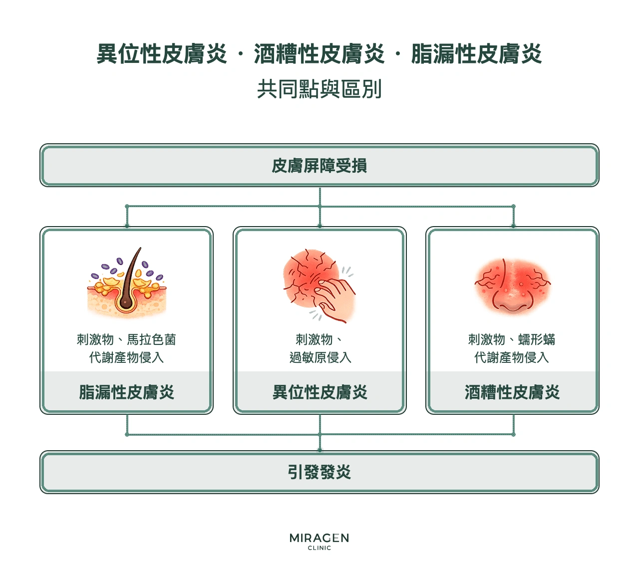 比較異位性皮膚炎、酒糟性皮膚炎與脂漏性皮膚炎的資訊圖：三者都從皮膚屏障受損開始，但主要加重因素分別為過敏原、蠕形蟎及馬拉色菌