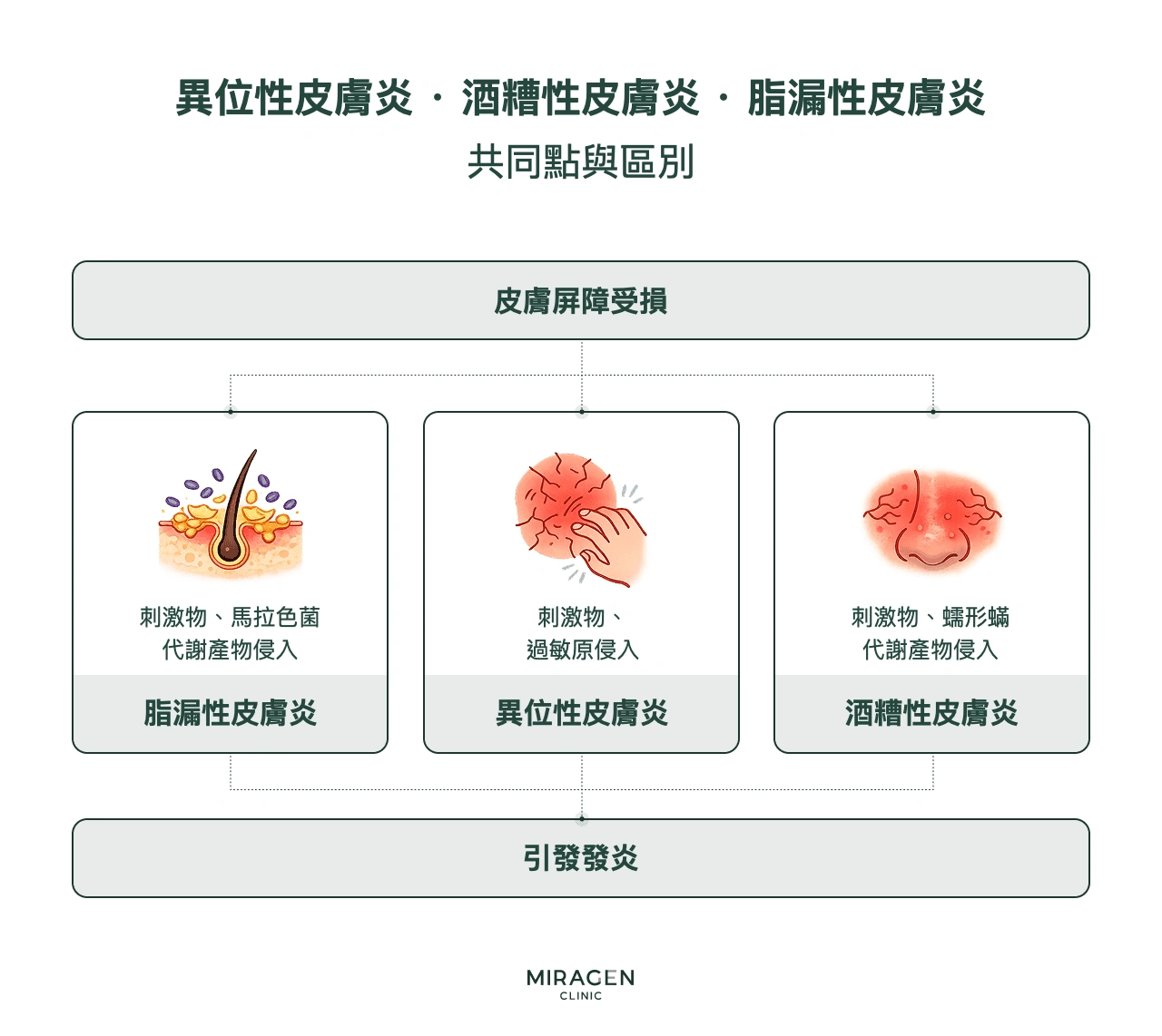 資訊圖:比較異位性皮膚炎、酒糟性皮膚炎和脂漏性皮膚炎;三者都有皮膚屏障損傷,但分別受到過敏原、毛囊蠕形蟎和馬拉色菌等不同刺激