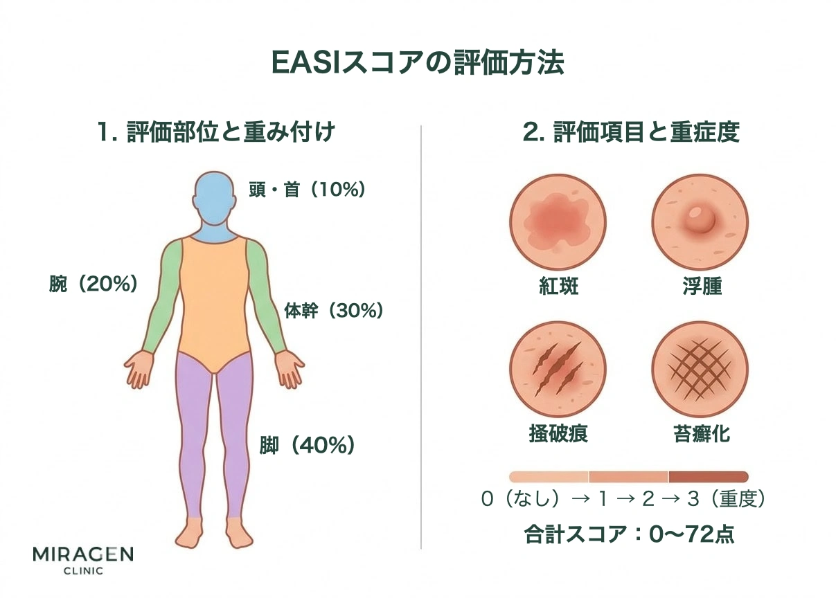 EASIスコアの評価方法を示すインフォグラフィック。頭部・頸部、体幹、腕、脚の4部位の重み付けと、紅斑、浮腫、掻破痕、苔癬化の4つの評価項目、および重症度スケールを表示している。