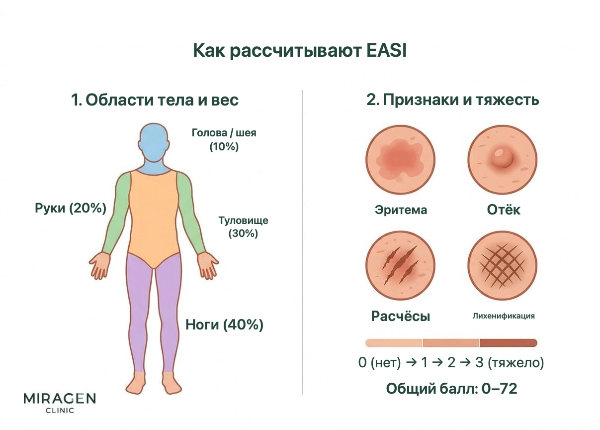 Инфографика о расчете EASI показывает веса четырех областей тела и четыре признака: покраснение, отек, расчесы и лихенификацию, а также шкалу их выраженности