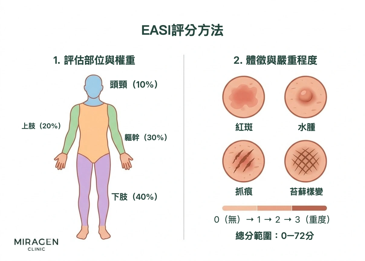 EASI 評分方法資訊圖,展示頭頸、上肢、軀幹和下肢四個部位的權重,以及紅斑、水腫、抓痕、苔蘚樣變四項評估內容和嚴重程度刻度