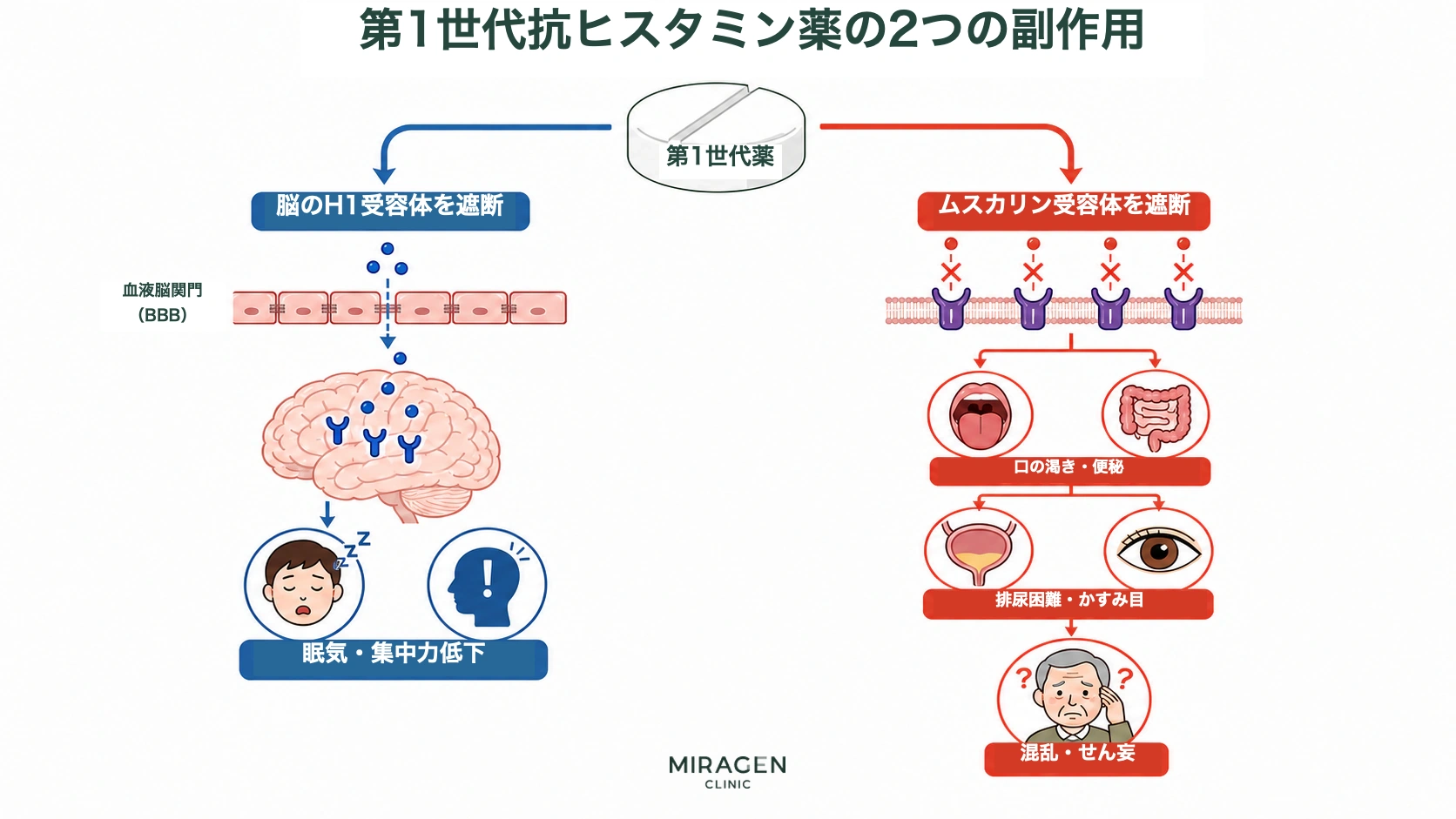 フェニラミン錠のような第1世代抗ヒスタミン薬が脳のH1受容体をブロックして眠気や集中力低下を引き起こし、ムスカリン受容体をブロックして口の渇き・便秘・排尿困難・視界のかすみ・錯乱・せん妄を引き起こす2つの経路を示した図